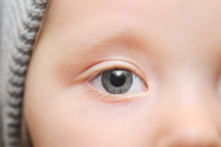 تشخیص 100 درصدی اوتیسم از شبکیه چشم کودکان با هوش مصنوعی